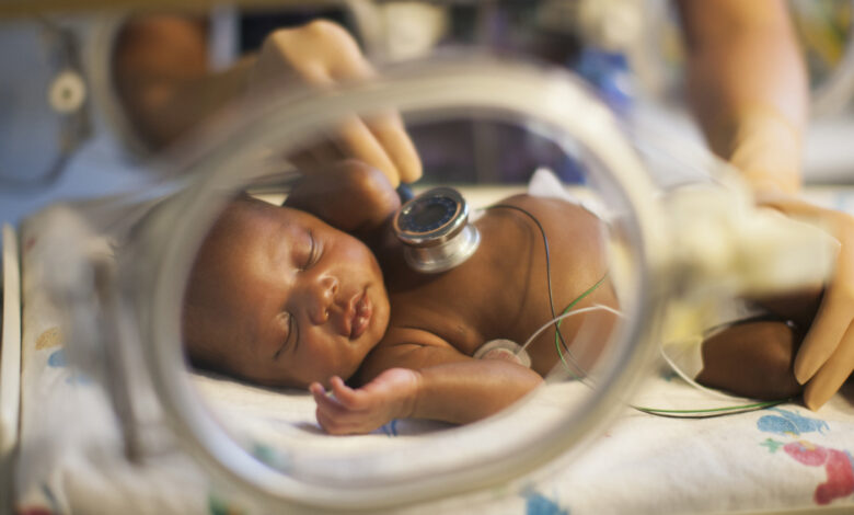 Understanding Micro Preemie Survival and NICU Care